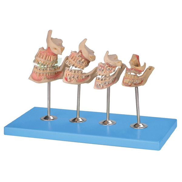 Human Teeth Model, Dentition Development