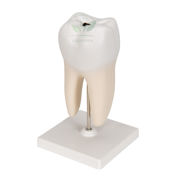 Human Teeth Model, Lower Molar with One Root